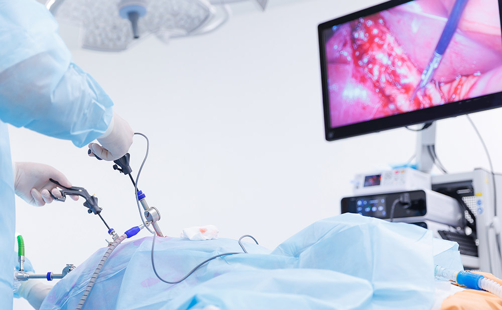 types of bariatric surgery, bariatric surgery Melbourne, laparoscopic bariatric surgery, weight loss surgery