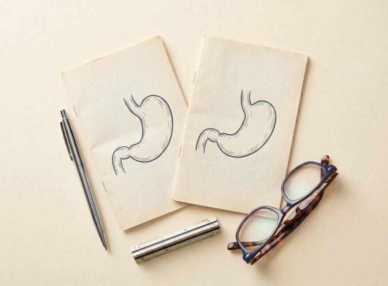 Sleeve or bypass A practical guide