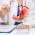 Types of Bariatric Surgery | Weight Loss Surgery Options | What is the Safest Form of Weight Loss Surgery
