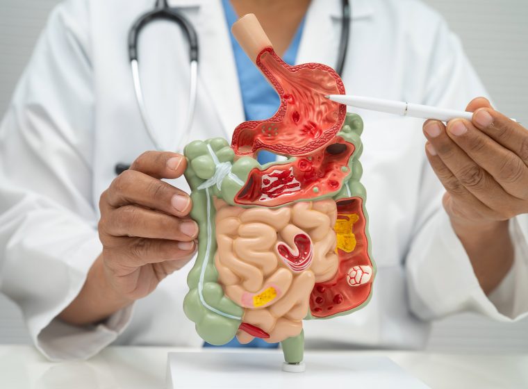 Gastric Bypass Surgery Melbourne | Gastric Bypass Surgery Cost Melbourne | Roux-en-y Gastric Bypass